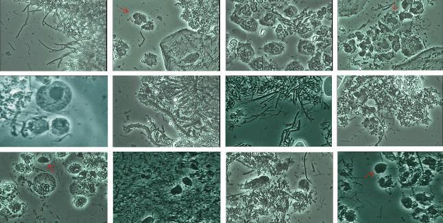 デンタルプラーク微生物画像集